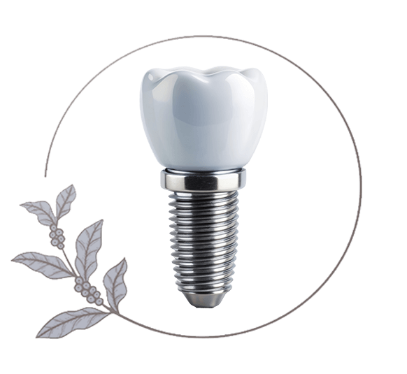 Close up frame of dental implant model