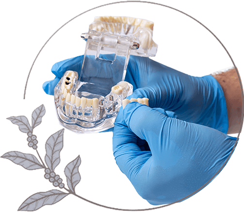 close up of full arch dental implant model being held up for viewing