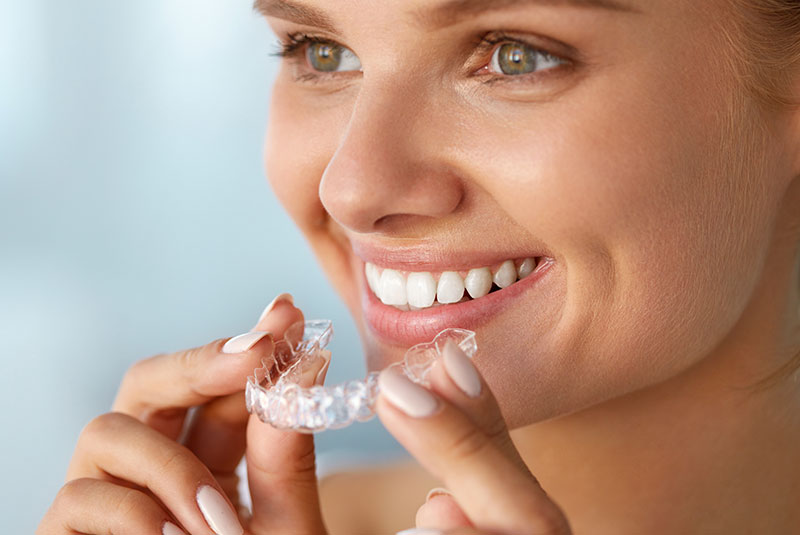 teeth whitening patient putting in their teeth whitening tray