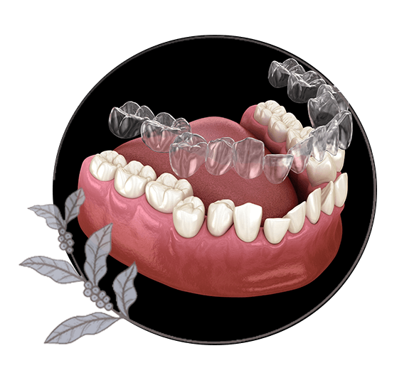 close up of dental Invisalign graphic